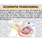 460 Ecografía Transvaginal.pdf